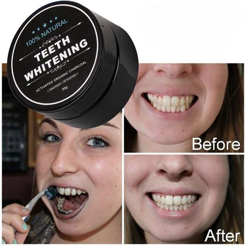 1 Kutu Aktif Kömür Diş Beyazla - Teeth Whitening Pens incelemesi ve fiyatı