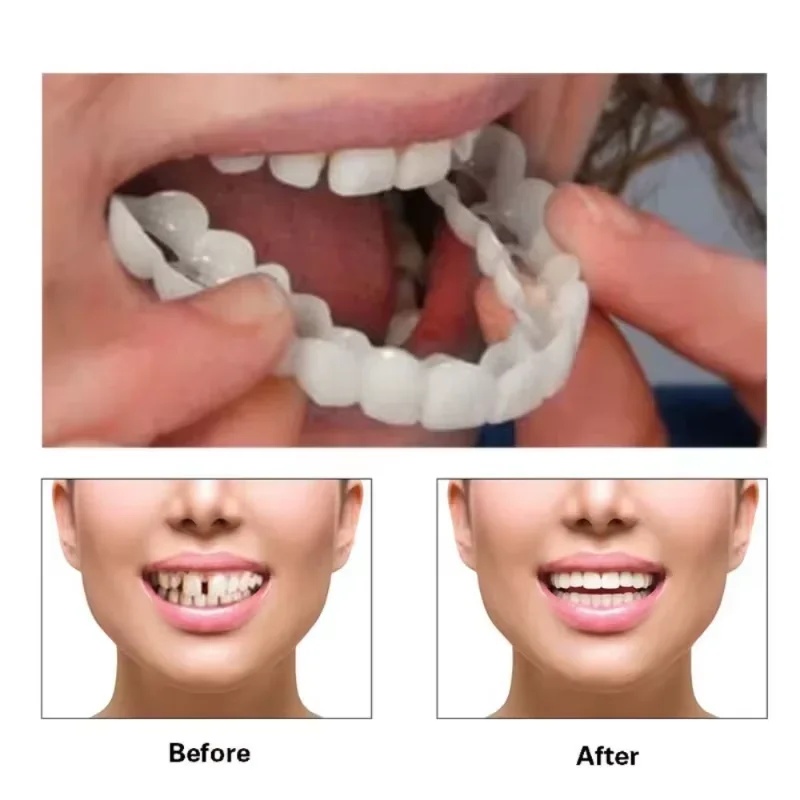 Çıkarılabilir Kaplama Diş Seti - Teeth Whitening Kit incelemesi ve fiyatı